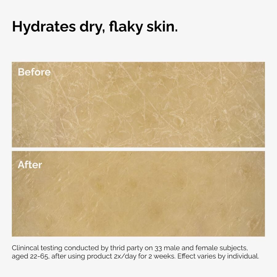 the-body-care-collection-a3 ord-natural-moisturizing-factors-inulin-body-before-after-graphic-02.jpg