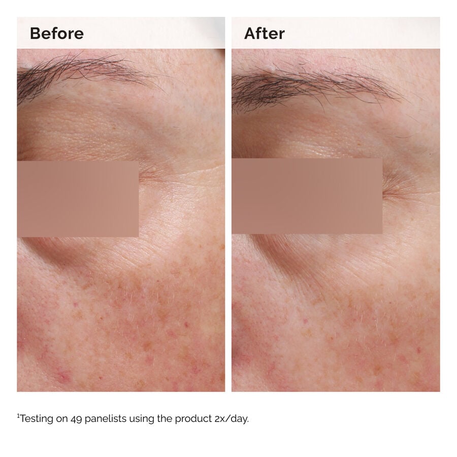 niacinamide-5-face-and-body-emulsion-q3 2024-08-23-ORD-Nia-5pct-Face-Body-B-A-Elasticity-Global-02-1x1.jpg