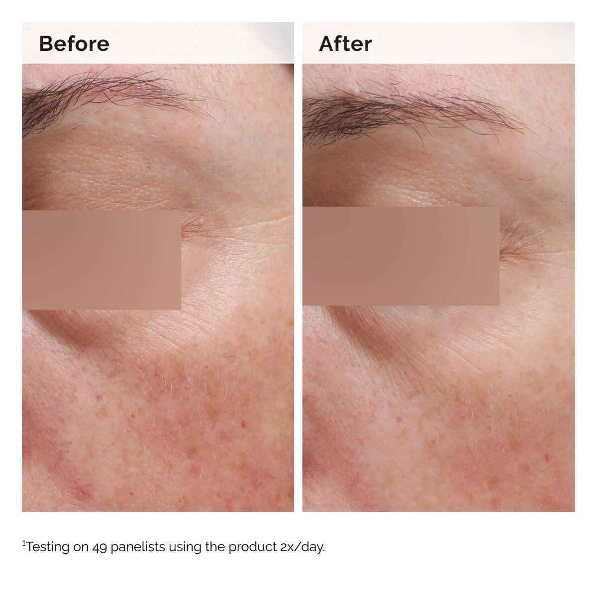 niacinamide-5-face-and-body-emulsion-q3 2024-08-23-ORD-Nia-5pct-Face-Body-B-A-Elasticity-Global-02-1x1.jpg