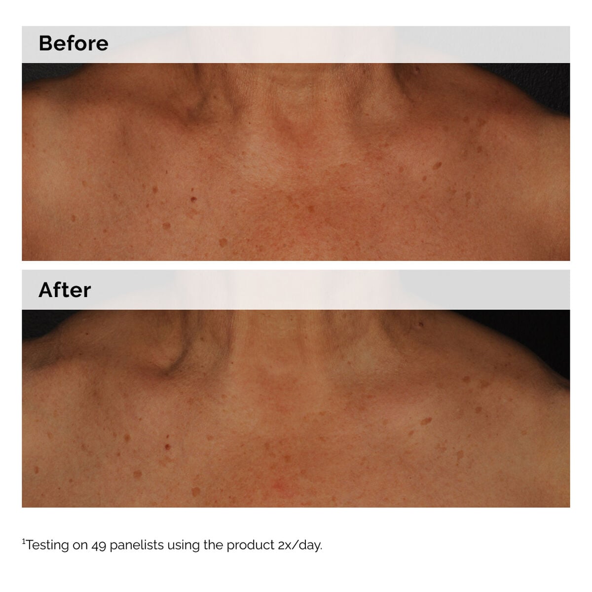 niacinamide-5-face-and-body-emulsion-q3 2024-08-23-ORD-Nia-5pct-Face-Body-B-A-Global-02-1x1.jpg