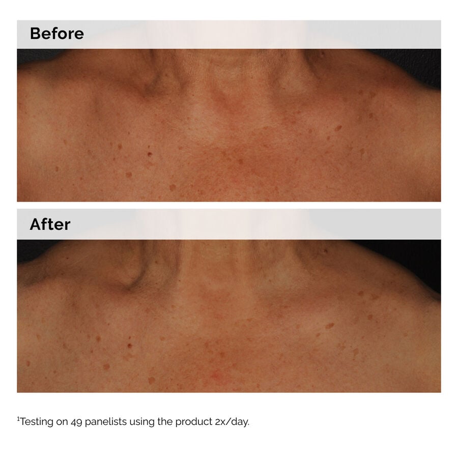 niacinamide-5-face-and-body-emulsion-q3 2024-08-23-ORD-Nia-5pct-Face-Body-B-A-Global-02-1x1.jpg