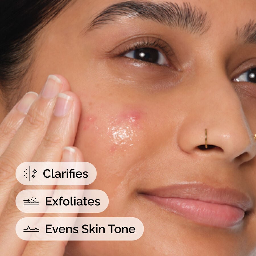 salicylic-acid-2-anhydrous-solution-j7 FY25-D41247-ORD-Web-PDP-SA-2pct-Anh-1x1-EN-4f.jpg