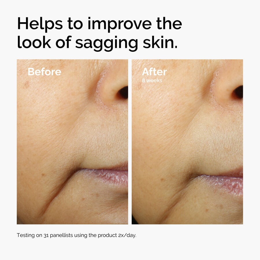 caffeine-3-escin-1-face-serum-w6 ord-caffeine-3pct-escin-1pct-face-serum-before-after-sagging.jpg