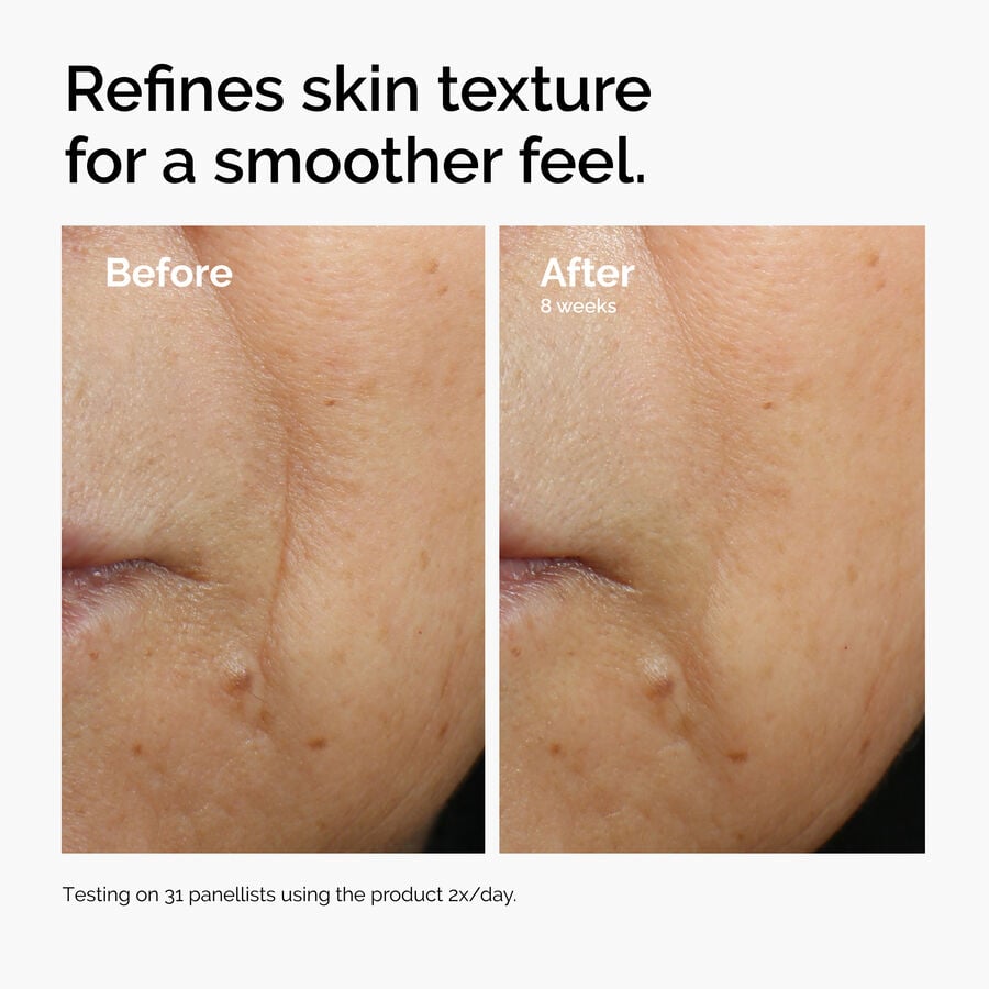 caffeine-3-escin-1-face-serum-w6 ord-caffeine-3pct-escin-1pct-face-serum-before-after-texture.jpg