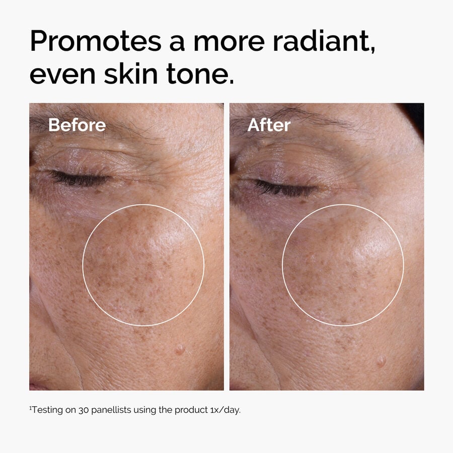 glycolic-acid-7-exfoliating-toner-n7 ord-glycolic-before-after-radiance.jpg