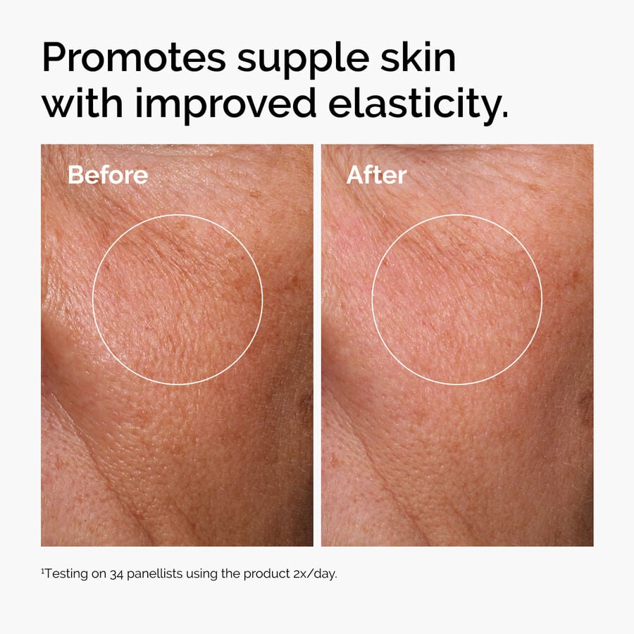 hyaluronic-acid-2-b5-with-ceramides-s7 ord-hyaluronic-acid-2pct-b5-hydrating-serum-before-after-elasticity.jpg