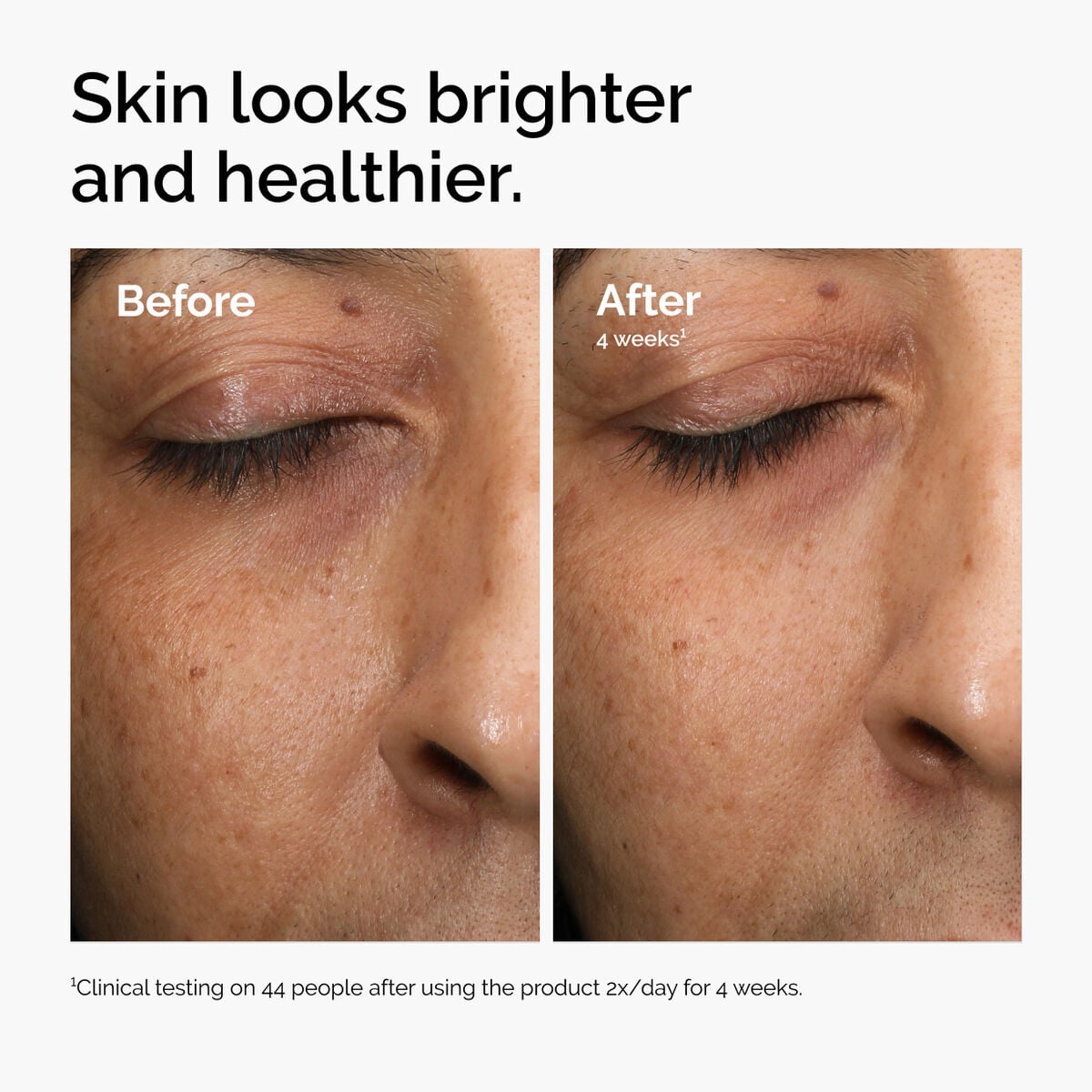multi-antioxidant-radiance-serum-k8 ord-mars-before-after-healthy.jpg