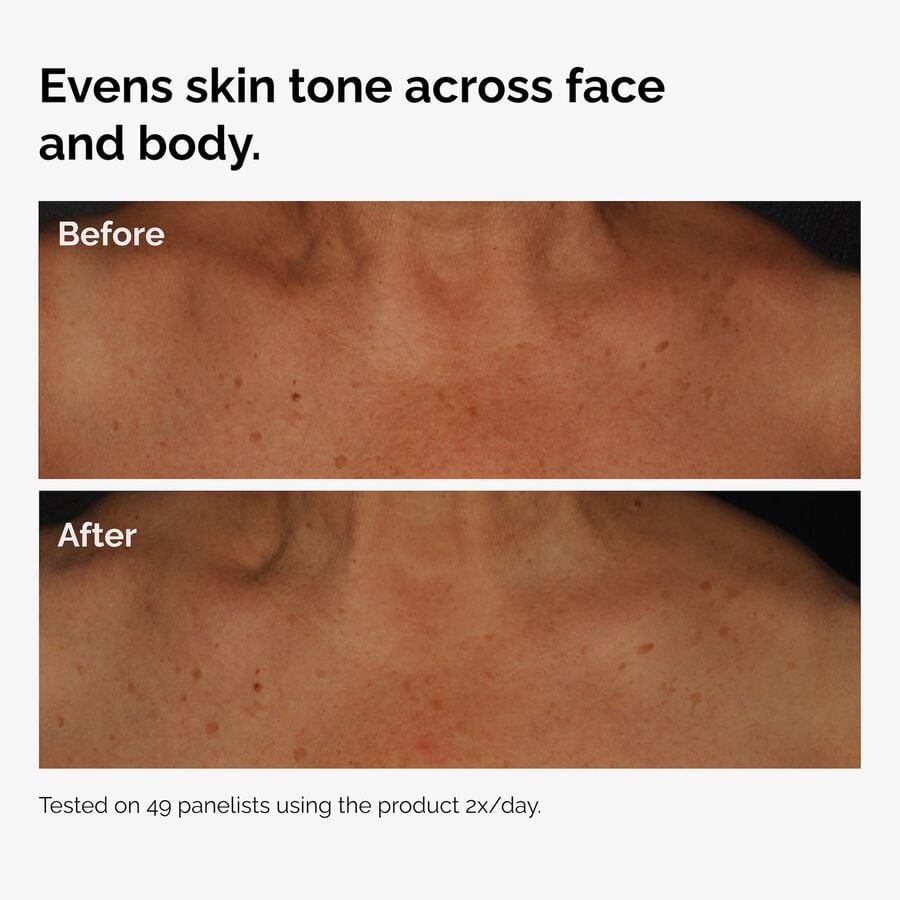 the-body-care-collection-a3 ord-niacinamide-face-body-serum-before-after-even-tone-graphic.jpg