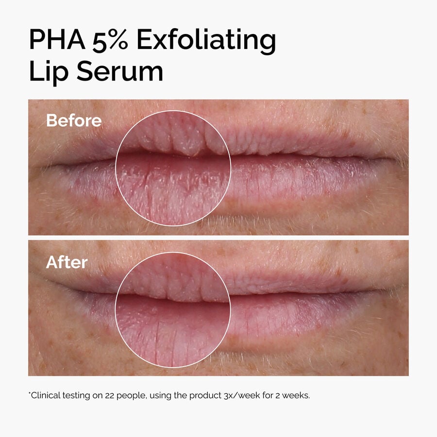 pha-5-exfoliating-lip-serum-q2 ord-pha-5pct-lip-exfoliating-serum-before-after.jpg