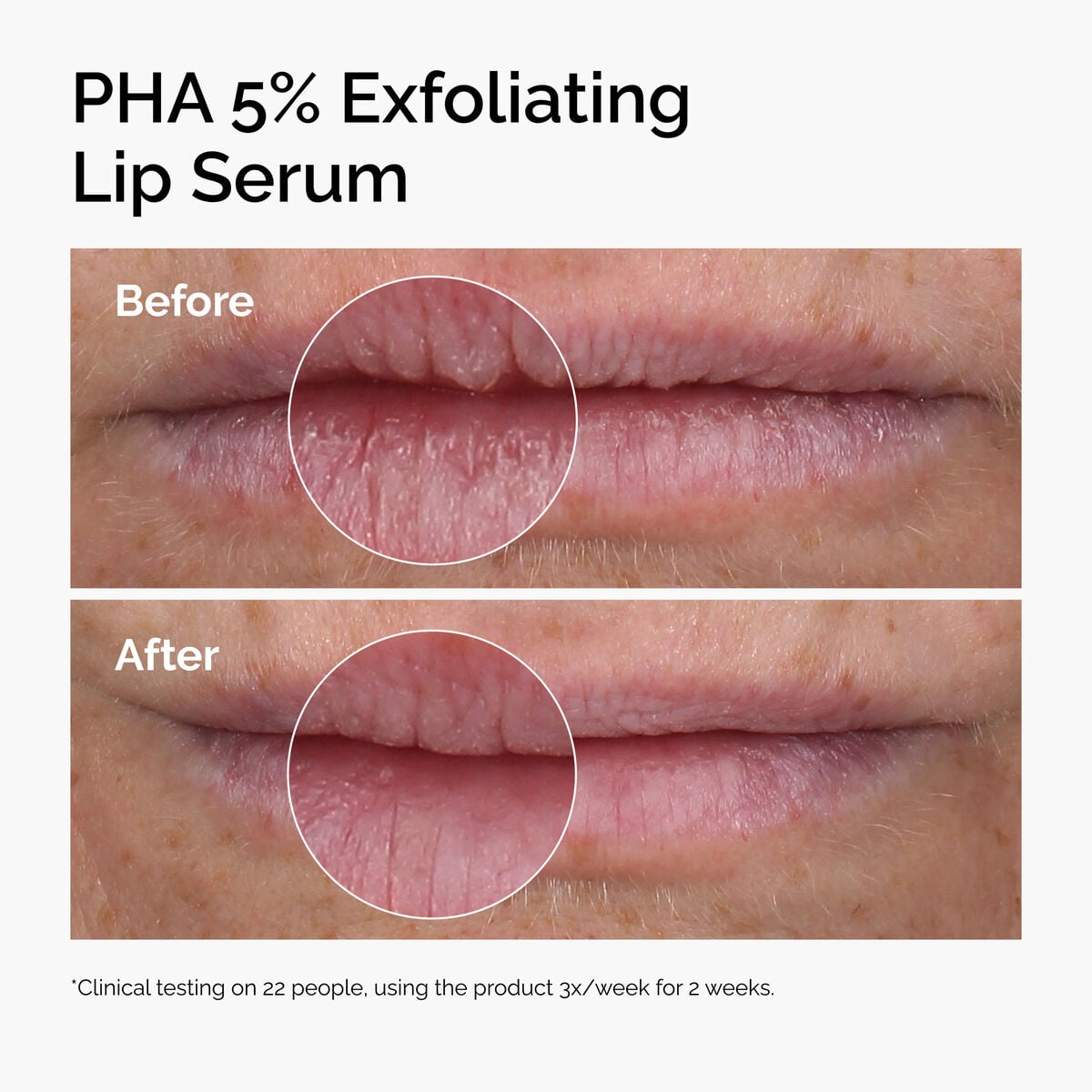 pha-5-exfoliating-lip-serum-c4 ord-pha-5pct-lip-exfoliating-serum-before-after.jpg